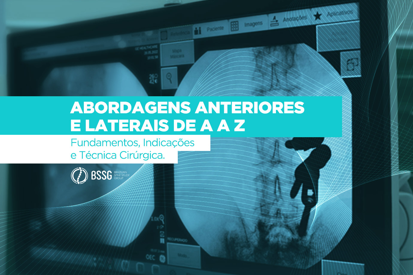 Abordagens Anteriores